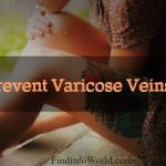 prevent varicose veins