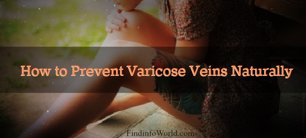 prevent varicose veins